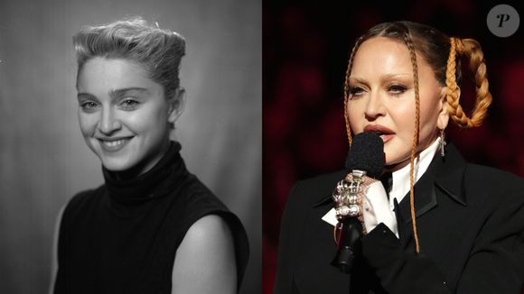Madonna foi um símbolo da beleza rebelde dos anos 80 e décadas subsequentes. Recentemente, causou polêmica por sua aparência diferente