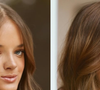Rafaella Justus fez rinoplastia com retirada de cartilagem da costela; médico explica método: ‘Enxertos para modelar o nariz’