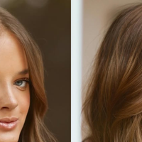 Rafaella Justus fez rinoplastia com retirada de cartilagem da costela; médico explica método: ‘Enxertos para modelar o nariz’