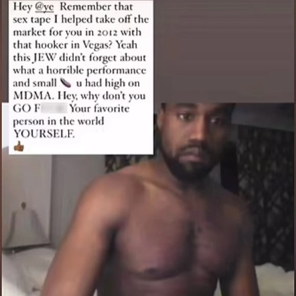 Depois das atitudes controversas de Kanye, Blatt resolveu mandar um recado afiado pelo Instagram. Ele postou uma foto do rapper sem camisa e soltou: