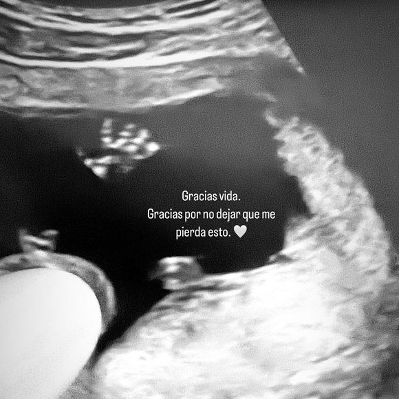 Ao publicar a foto, Joana Sanz agradeceu pela vida do filho.