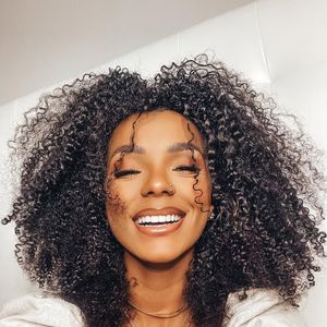 Brunna Gonçalves apostou em técnicas pouco invasivas, como botox e preenchimento