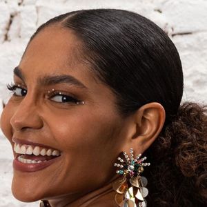 Mudanças na rotina ajudam a aliviar sintomas do lipedema como o de Bárbara Reis