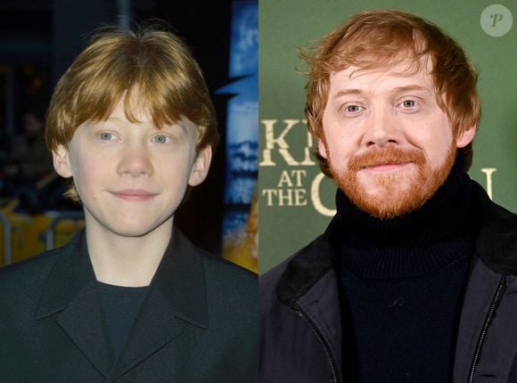 Antes e depois do ator Rupert Grint, de 'Harry Potter'