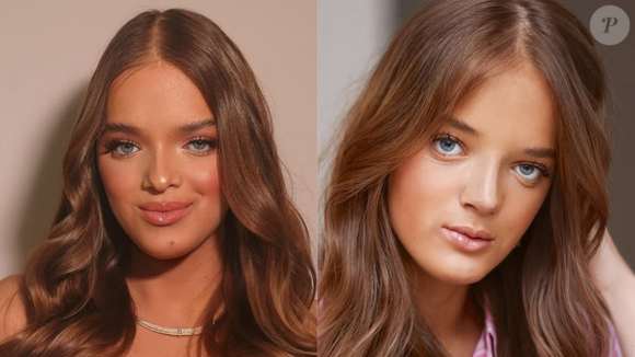 Rafaella Justus passa por segunda rinoplastia: veja antes e depois