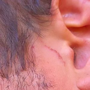 Dado Dolabella mostrou o rosto machucado após supostamente ter levado um tapa de Marcela Tomaszewski