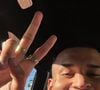 Conhecido nas redes sociais por vídeos de dança e humor, Anderson Neiff foi baleado após deixar um show em SP. O cantor, que soma milhões de seguidores, foi socorrido e segue internado após procedimento cirúrgico