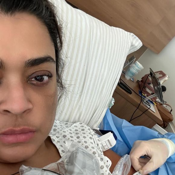 Preta Gil foi operada ao longo de 21 horas; cantora está com câncer, que entrou em metástase