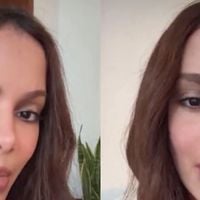 'Seria ainda mais horrível para minha vida...': após nova plástica, Anitta reage a rumores de 'problema psicológico' por rosto diferente