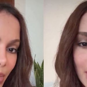 Anitta reage a rumores de 'problema psicológico' após surgir com rosto diferente devido a nova plástica: 'Seria ainda mais horrível'