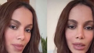 'Seria ainda mais horrível para minha vida...': após nova plástica, Anitta reage a rumores de 'problema psicológico' por rosto diferente