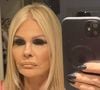 Monique Evans mostra resultado de mini-lifting facial