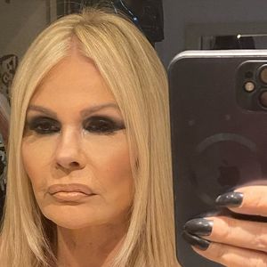 Monique Evans mostra resultado de mini-lifting facial