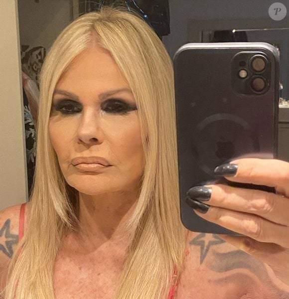 Monique Evans mostra resultado de mini-lifting facial