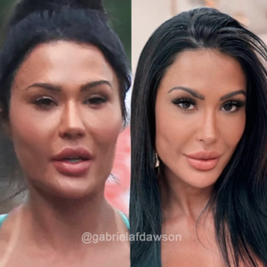 Antes e depois de Gracyanne Barbosa impressiona a web pela naturalidade adotada pela influenciadora