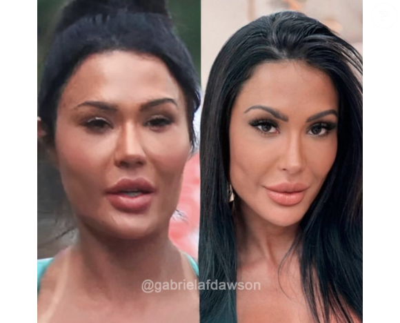 Antes e depois de Gracyanne Barbosa impressiona a web pela naturalidade adotada pela influenciadora