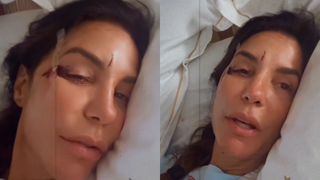 Ivete Sangalo mostra rosto com ferimentos após desmaiar em casa; cantora está internada em Salvador