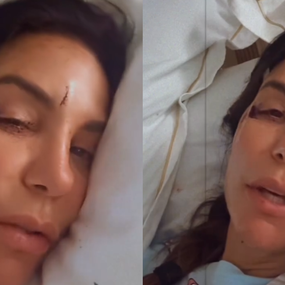 Ivete Sangalo mostra rosto com ferimentos após desmaiar em casa; cantora está internada em Salvador