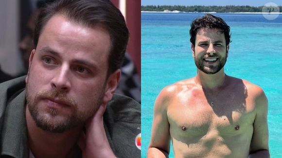 Também do 'BBB 22', Gustavo Marsengo trocou seu rosto natural pela harmonização facial e transplante capilar