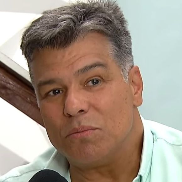 Rosto de Maurício Mattar ficou bastante diferente após o procedimento, que gerou elogios