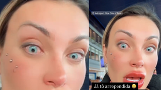 ‘Está doendo muito!': Andressa Urach admite estar 'arrependida' de ter mudado a cor dos olhos com cirurgia e pede orações