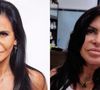 Gretchen alterou seu rosto com muitos procedimentos estéticos ao longo da carreira