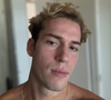 Aos 20 anos, Pietro Antonelli conta mudança importante na alimentação para melhorar cuidados com a pele: ‘O que evito é…’