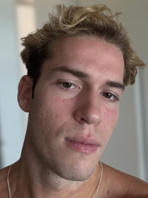 Aos 20 anos, Pietro Antonelli conta mudança importante na alimentação para melhorar cuidados com a pele: ‘O que evito é…’