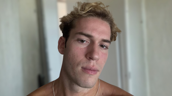 Aos 20 anos, Pietro Antonelli conta mudança importante na alimentação para melhorar cuidados com a pele: ‘O que evito é…’