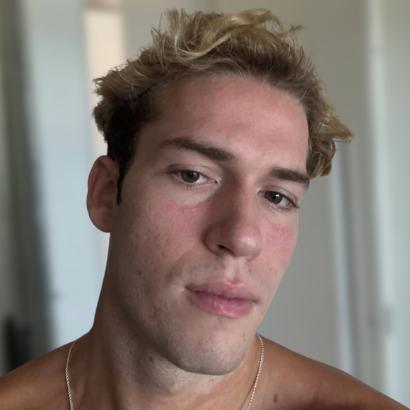 Aos 20 anos, Pietro Antonelli conta mudança importante na alimentação para melhorar cuidados com a pele: ‘O que evito é…’
