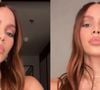 A cantora Anitta contou que ouviu que precisava ser bonita para dar certo na carreira e associou as mudanças estéticas à abertura de novas oportunidades