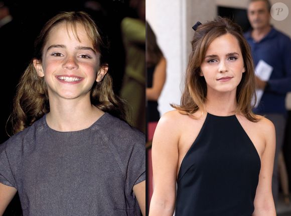 Antes e depois da atriz Emma Watson, de 'Harry Potter'