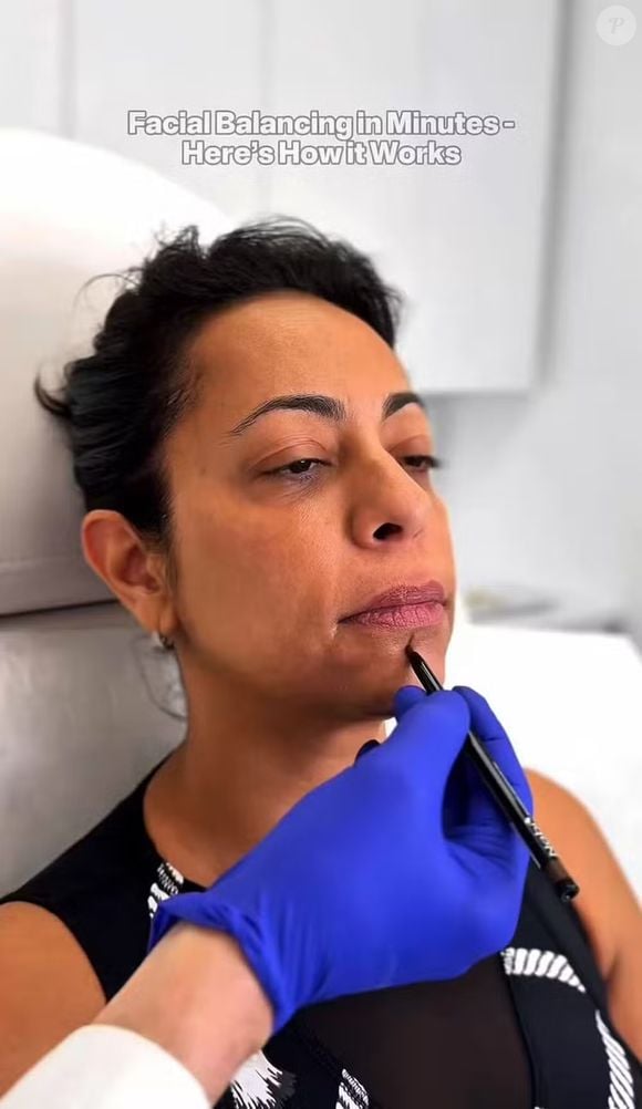 Com o cabelo curto, Samantha Schmütz apareceu fazendo alguns procedimentos estéticos para acabar com a flacidez em seu rosto