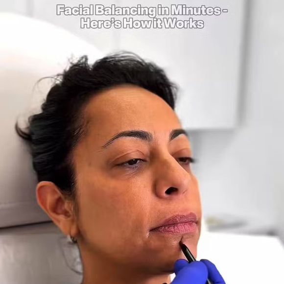 Com o cabelo curto, Samantha Schmütz apareceu fazendo alguns procedimentos estéticos para acabar com a flacidez em seu rosto