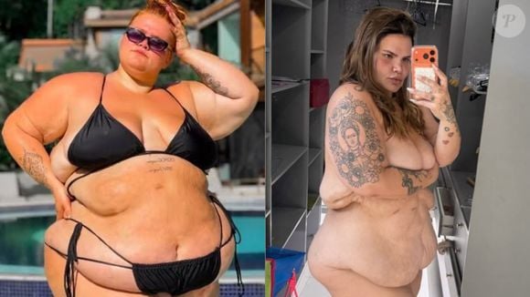 Antes e depois de Thais Carla: influenciadora perdeu 85 kg após uma cirurgia bariátrica, mas ainda não fez a remoção de pele