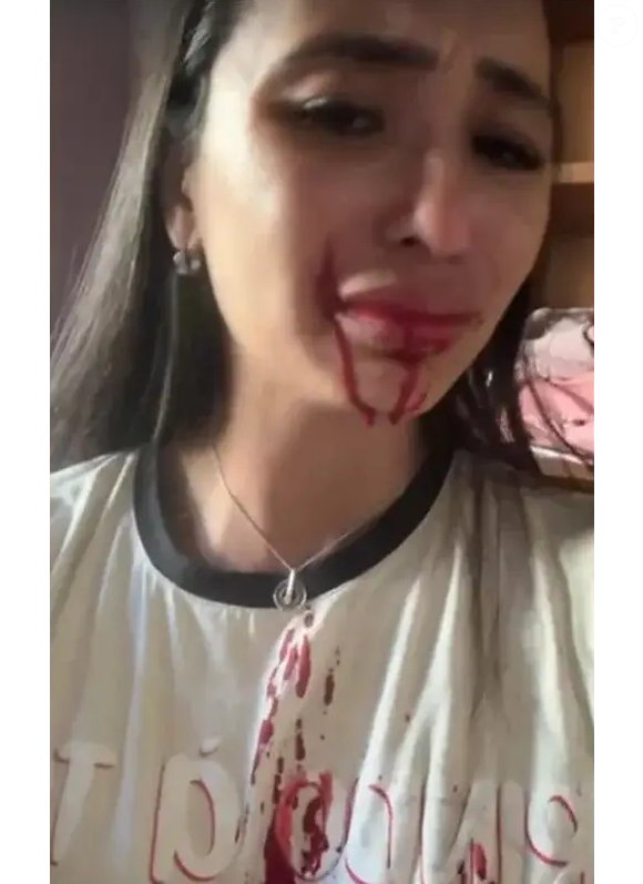 Pablinny gravou um vídeo para mostrar o sangue na face. 'Tô cuspindo sangue. Olha minha cara com a faca que ela tacou em mim', diz ela aos prantos