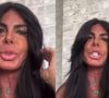 Gretchen passou recentemente por um novo procedimentos estéticos mas, desta vez, para retirar preenchedores