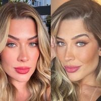 O que aconteceu com o rosto de Renata Muller? Em 'A Fazenda 17', ex de Victor Pecoraro choca com super harmonização facial; antes e depois em 35 fotos é chocante!