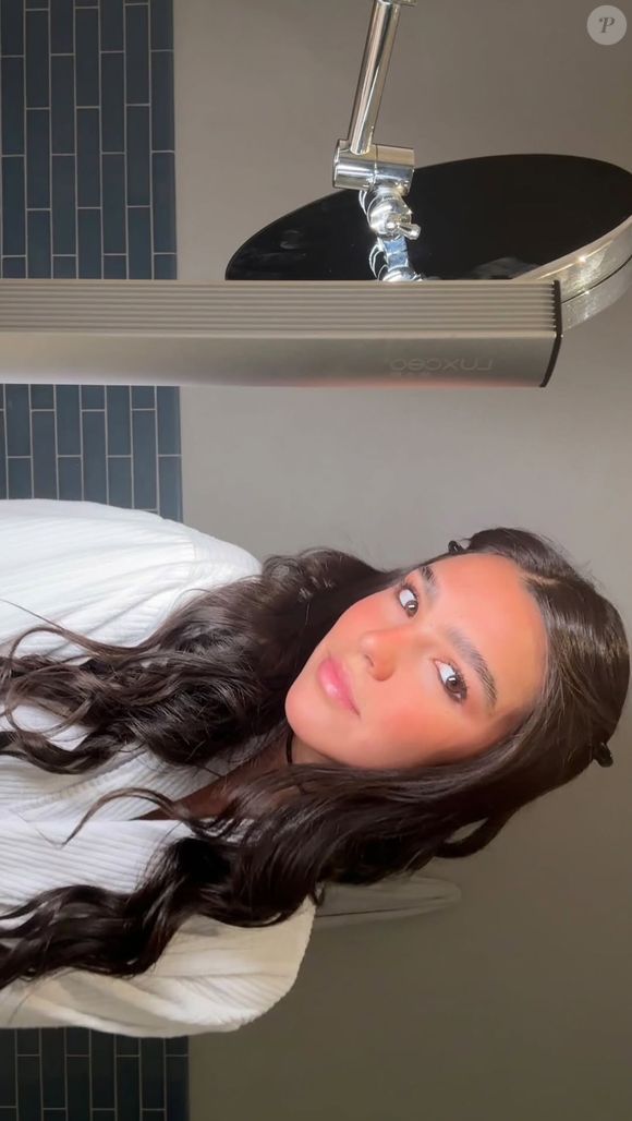 Hiperidrose, condição de Duda Guerra, pode afetar axilas, mãos, pés e rosto