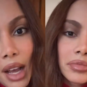 Sem 'pé na cova', sem cara 'desfigurada': Anitta fala pela 1ª vez sobre nova plástica no rosto. 'Eu sempre fiz, mas…'