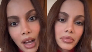 Sem 'pé na cova', sem cara 'desfigurada': Anitta fala pela 1ª vez sobre nova plástica no rosto. 'Eu sempre fiz, mas…'