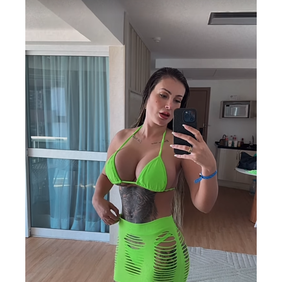 Antes e depois de Andressa Urach: modelo já teve o cabelo castanho, e também implantou 1L de silicone em cada um dos seios, em 2024.