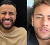 Antes e depois sósia do Neymar: influenciador gasta mais de R$ 40 mil em rinoplastia para ficar idêntico ao jogador