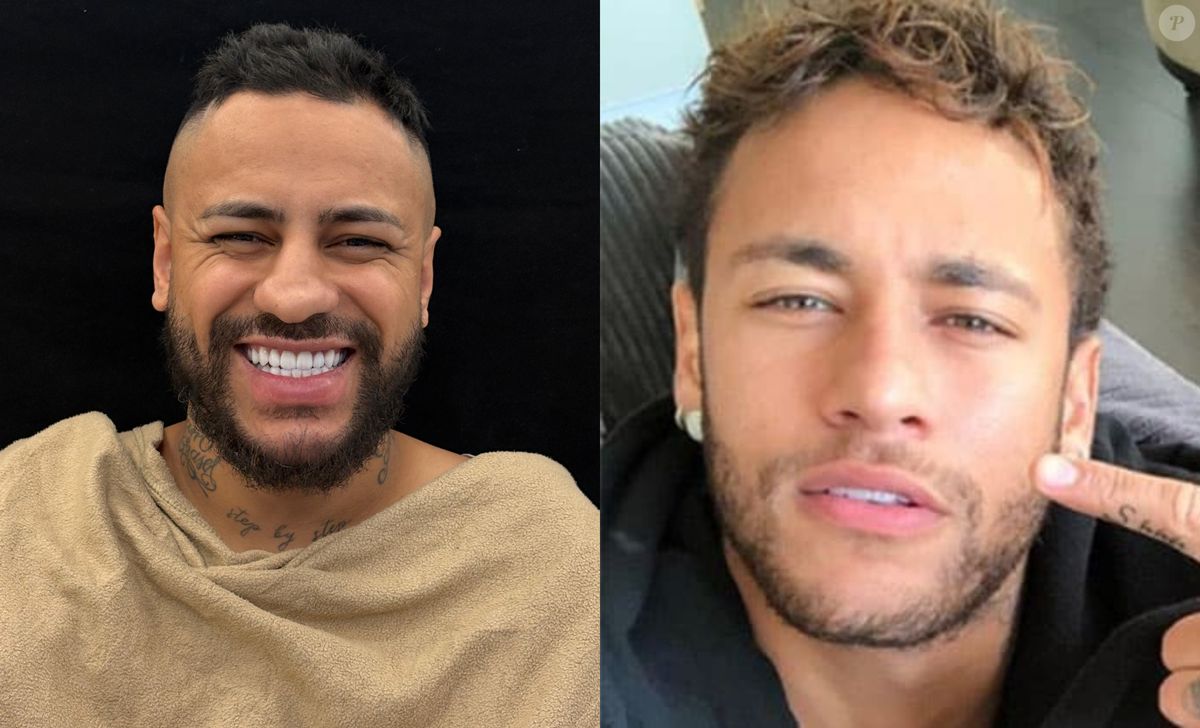 Foto: Antes e depois sósia do Neymar: influenciador gasta mais de R$ 40 ...