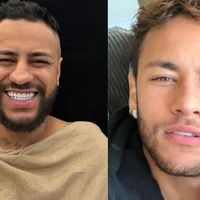 Antes e depois sósia do Neymar: influenciador gasta mais de R$ 40 mil em rinoplastia para ficar idêntico ao jogador