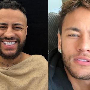 Antes e depois sósia do Neymar: influenciador gasta mais de R$ 40 mil em rinoplastia para ficar idêntico ao jogador