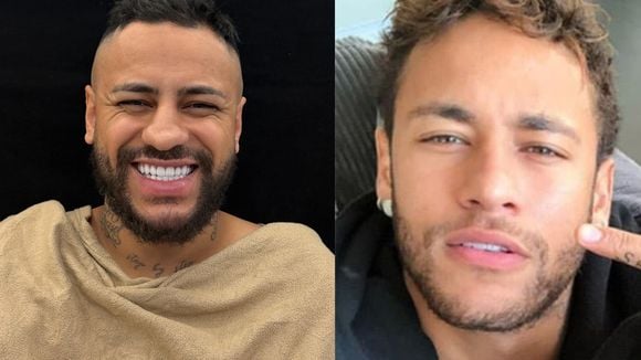 Antes e depois sósia do Neymar: influenciador gasta mais de R$ 40 mil em rinoplastia para ficar idêntico ao jogador