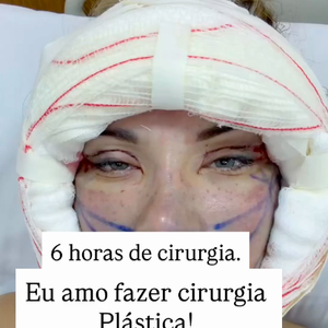 Andressa Urach vem mostrando os detalhes de seu processo de recuperação para os fãs. Segundo a modelo, a cirurgia demorou 6 horas