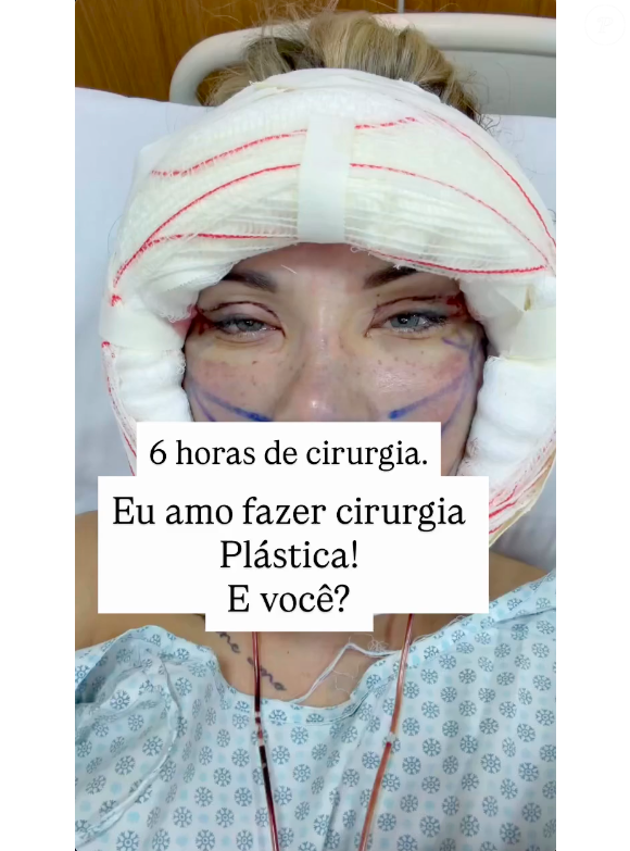 Andressa Urach vem mostrando os detalhes de seu processo de recuperação para os fãs. Segundo a modelo, a cirurgia demorou 6 horas