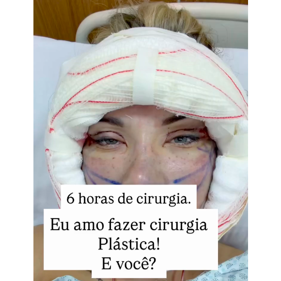 Andressa Urach vem mostrando os detalhes de seu processo de recuperação para os fãs. Segundo a modelo, a cirurgia demorou 6 horas